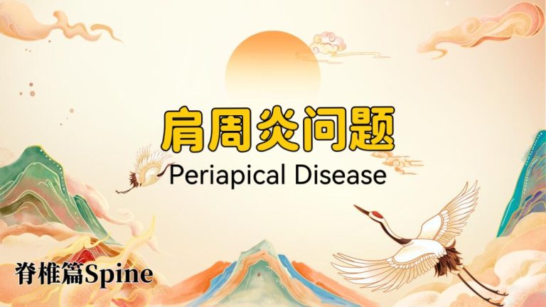 Tai Chi for Shoulder Mobility: Natural Relief for Frozen Shoulder, Stiffness & Rotator Cuff Recovery